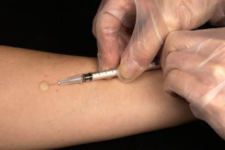 Bezpłatne szczepionki na grypę w Opolu. Gdzie dostać?