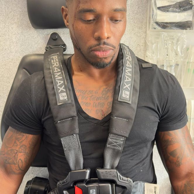 Influencerka kręciła film na Instagrama. Nagle uderzyło w nią auto!