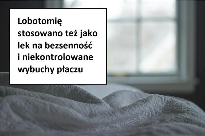 W tych przypadkach stosowano lobotomię