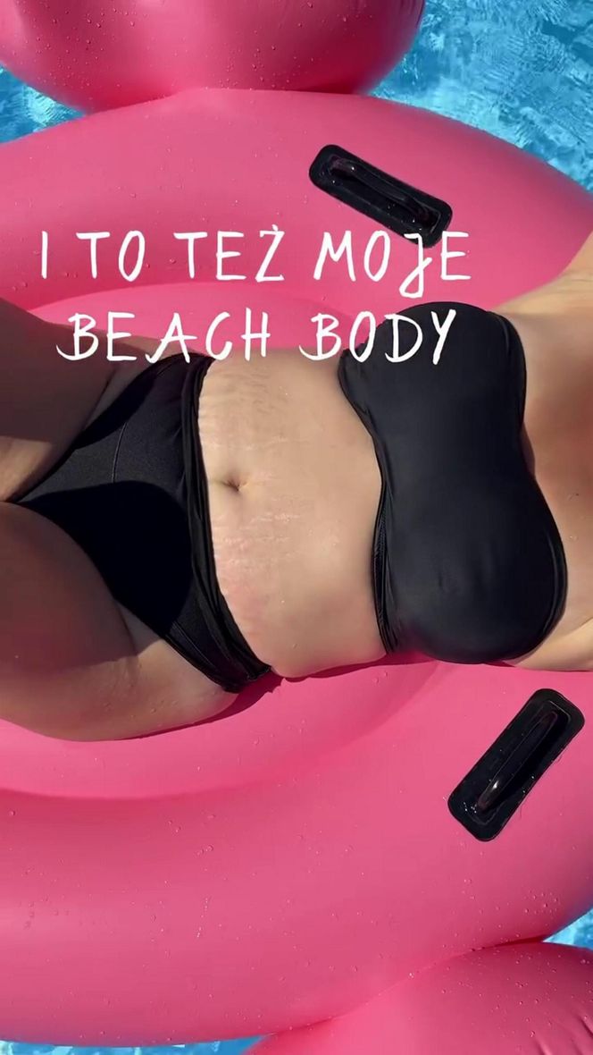 Dorota Szelągowska nie wstydzi się rozstępów