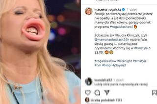 Ogromne usta Marzeny Rogalskiej! Co ona z sobą zrobiła?!