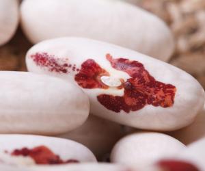 Fasolka z orzełkiem wraca do łask. Kiedyś tajna, dziś ochroni przed zakrzepami