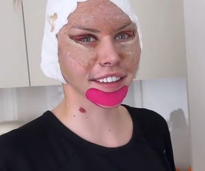 Julia Von Stein po operacji 