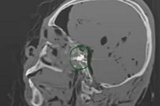 Ujawnił prawdę o sztucznej inteligencji. Znaleziono go martwego