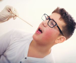 Angina Plauta-Vincenta: przyczyny, objawy, leczenie