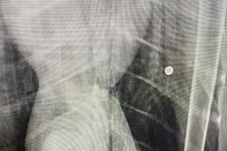 Łabędzica Lusia postrzelona w dziób i skrzydło