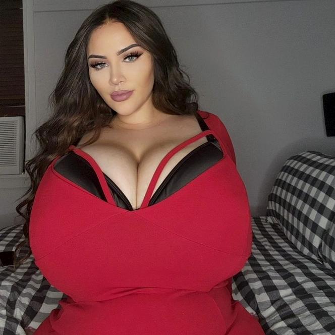 Piersi popularnej tiktokerki nie chcą przestać rosnąć. To wyjątkowo rzadka choroba