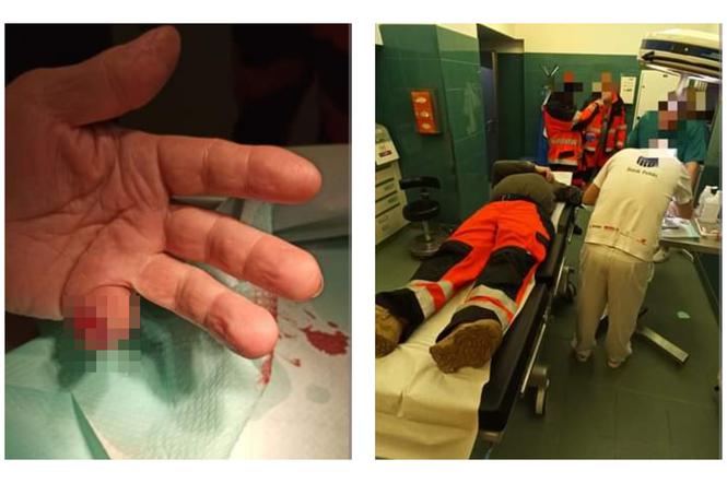 Medyka. Obywatel Turkmenistanu odgryzł palec ratownikowi medycznemu [ZDJĘCIA]