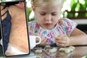 Rozpoznasz ostrą reakcję alergiczną u dziecka? Może wyglądać przeróżnie [ZDJĘCIA]
