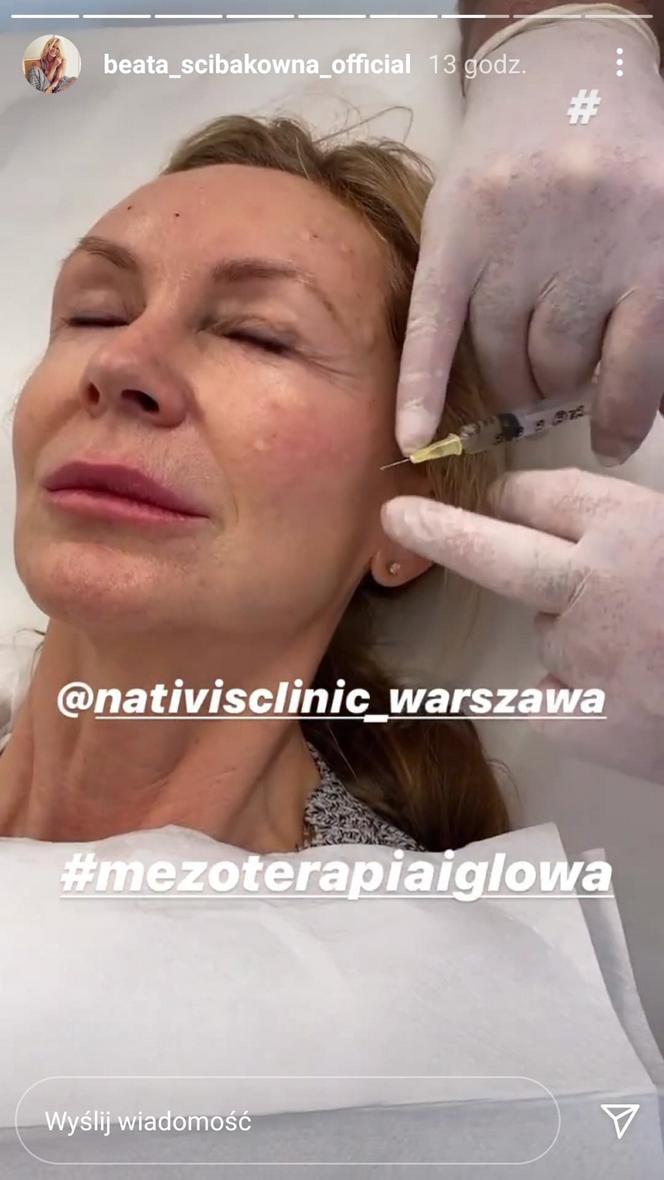 Beata Ścibakówna poprawiła sobie twarz i nie zakłada maseczki