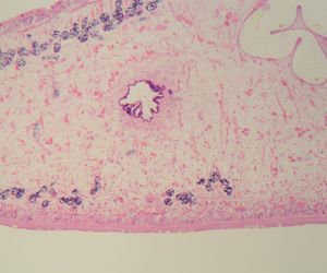 Motylica wątrobowa i fascjoloza - objawy, leczenie i diagnostyka