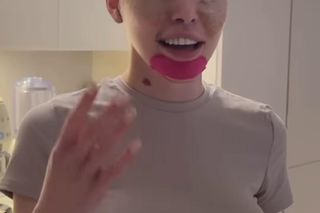 Julia von Stein po operacji