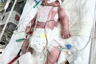 Mały Krzyś ma połowę serduszka, ale rodzice kochają go całym sercem. Ruszyła zbiórka [ZDJĘCIA]