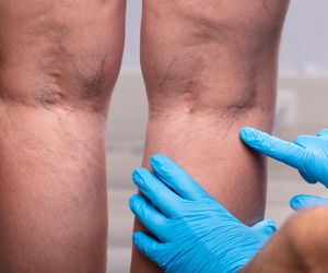 Ból nóg nasila się przy chodzeniu? Zagrożone są twoje płuca i serce