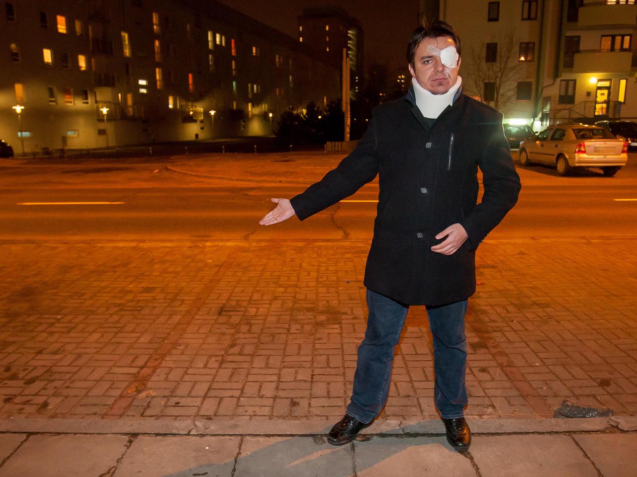 Skatowała mnie straż miejska!