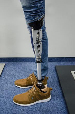 Od amputacji do „stanięcia na nogi” – jak wygląda proces protezowania?