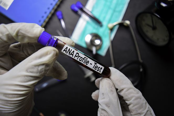 Test diagnostyczny ANA (przeciwciał przeciwjądrowych)