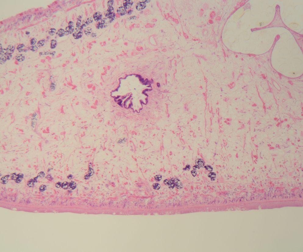 Motylica wątrobowa - objawy, leczenie i diagnostyka