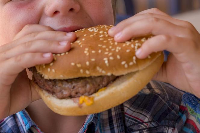 Dzieci z otyłością dwukrotnie bardziej narażone na „chorobę tysiąca twarzy”. Nowe badanie