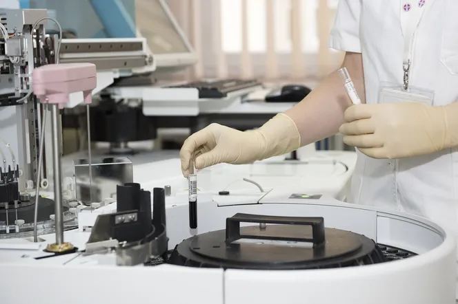 Porzucona naczepa z chemikaliami przy Marino. Czy substancja jest niebezpieczna?