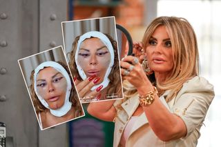 Kaźmierska pokazała zmaltretowaną twarz. Przeżywa istny koszmar! 