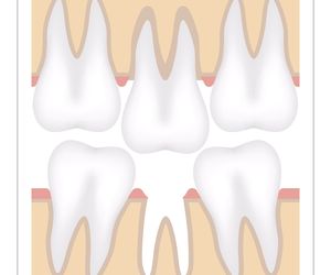 Efekt Godona - przyczyny i leczenie objawu Godona
