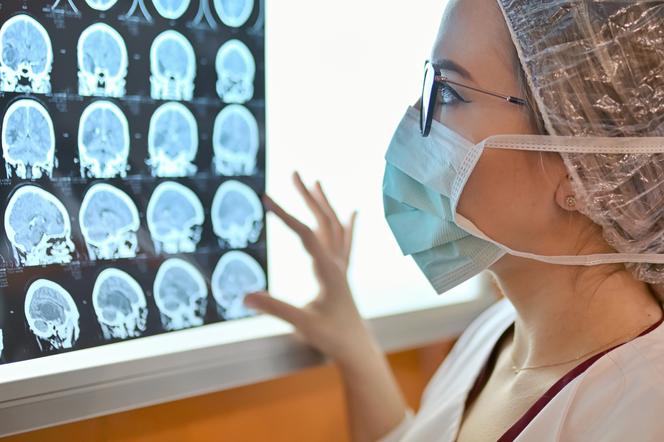 neurolog ogląda skany mózgu