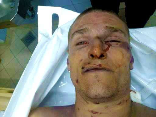 Igor Stachowiak zmarÅ‚ w komisariacie we WrocÅ‚awiu