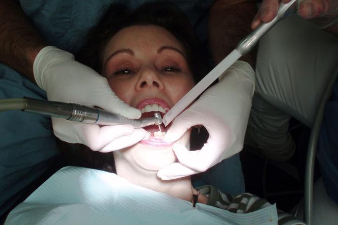 Polaków nie stać na leczenie stomatologiczne. Milena Czarnocka z Nakor: wolę wyrwać bolącego zęba niż płacić 400 zł lub więcej!
