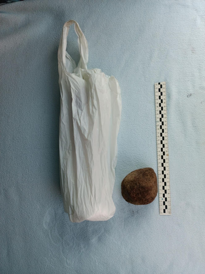 Zabił i przebrał się za Mikołaja