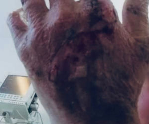 Dramat rodziny po wybuchu gazu. Ciężko poparzone dzieci.  Łzy na naszych policzkach płyną nieustannie [DRASTYCZNE ZDJĘCIA]