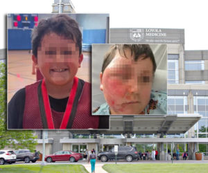 Wsadził do mikrofali gniotka, eksplodował mu na twarz. 9-latek oszpecony na zawsze