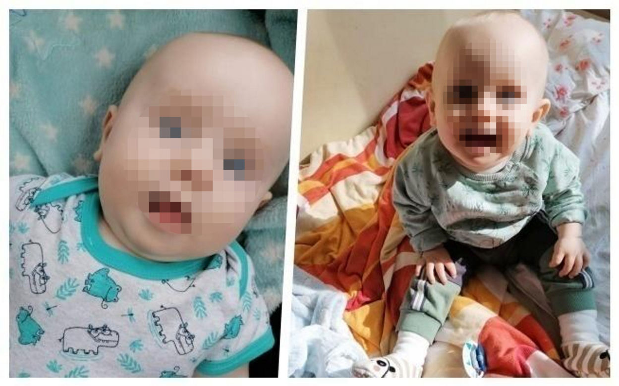 Mały Marcelek z Wyszogrodu walczy o powrót do normalności! Jego mama dowiedziała się o chorobie synka w dniu porodu [ZDJĘCIA]