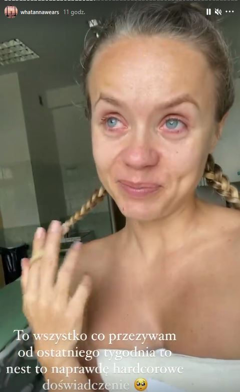 Dramat gwiazdy TVN. Anna Skura po operacji piersi