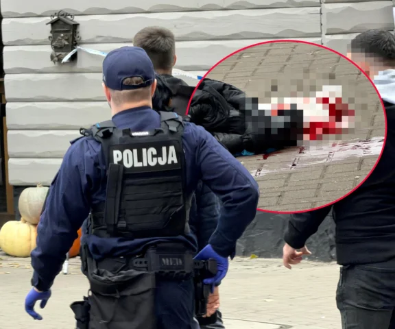 Zranił mężczyznę w głowę i uciekł. Trwają poszukiwania
