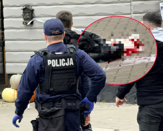 Krwawy atak 17-centymetrowym tasakiem w centrum Warszawy. Areszt dla podejrzanego