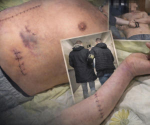 Stanął w obronie kobiety, skatowali go maczetami. Piotrek ledwo przeżył. Niemal mnie zabili