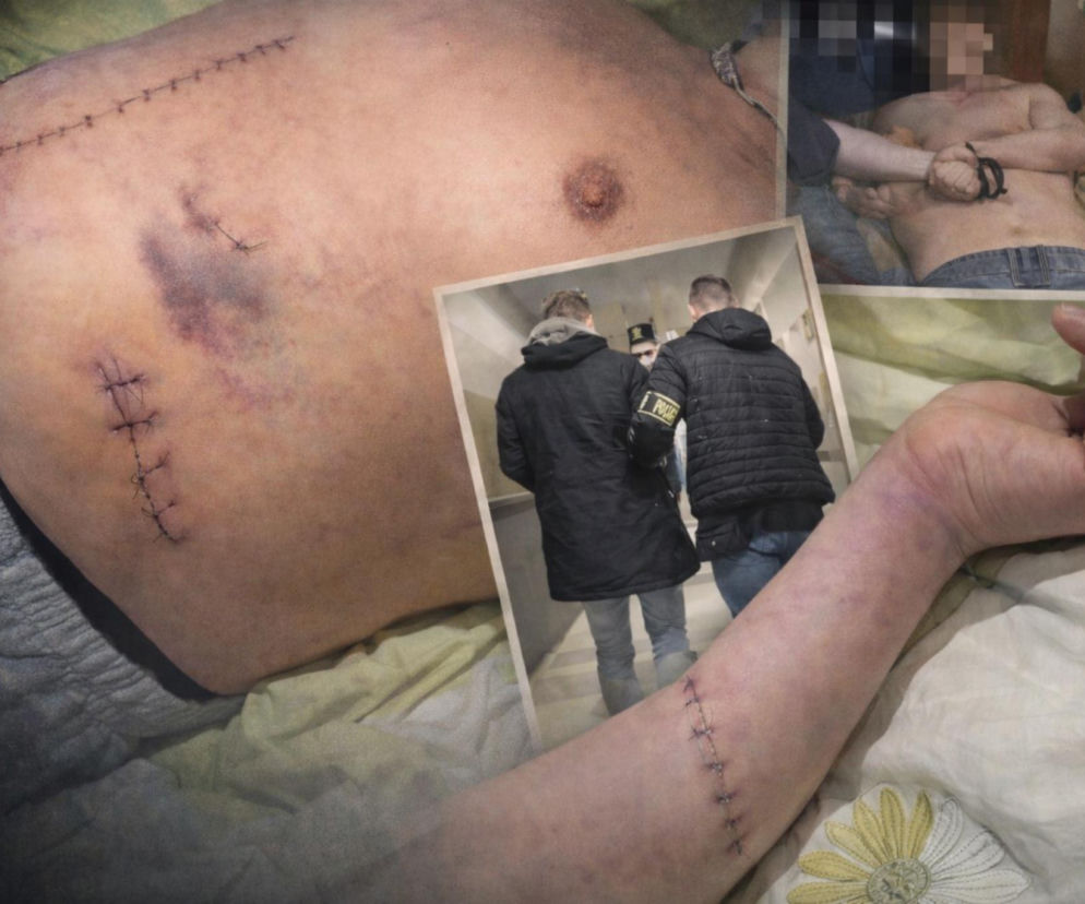 Stanął w obronie kobiety, skatowali go maczetami. Piotrek ledwo przeżył. Niemal mnie zabili