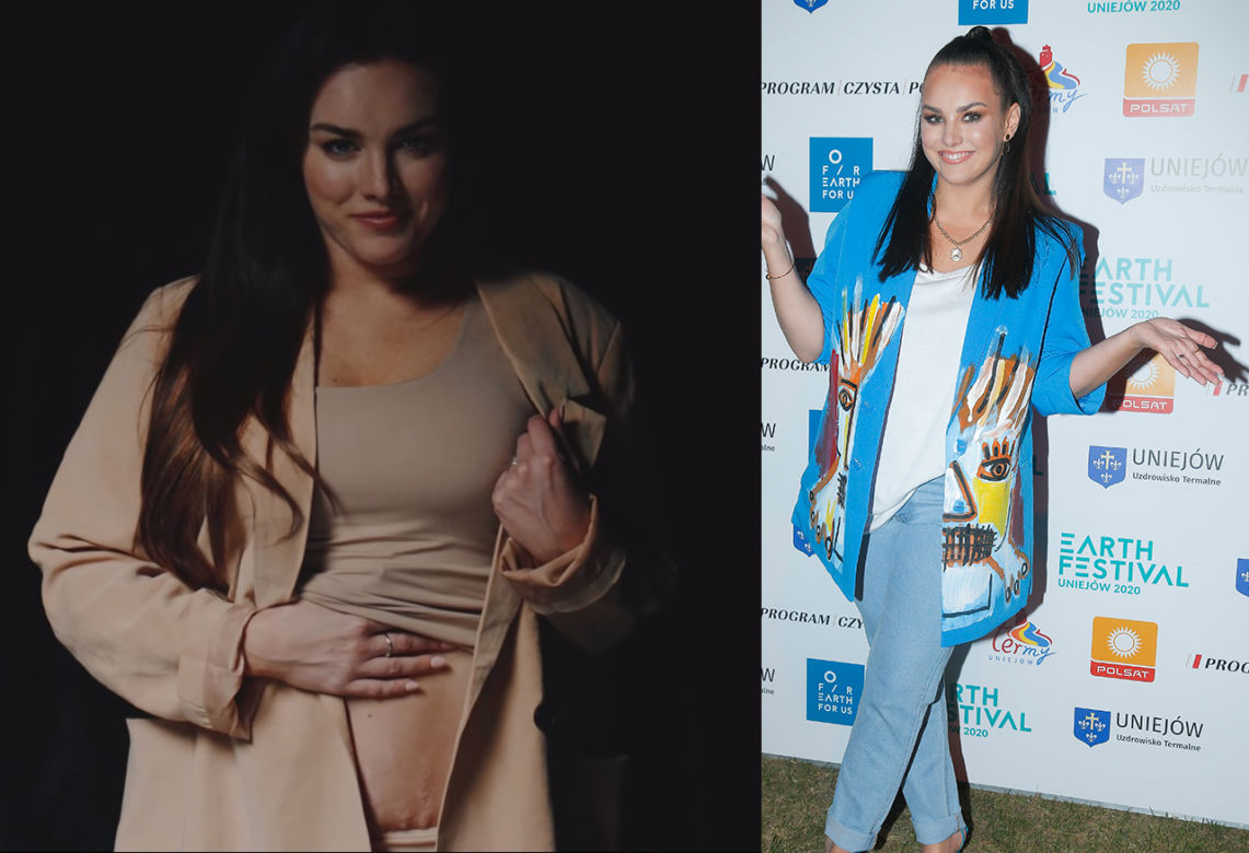 Ewa Farna pokazuje rozstępy