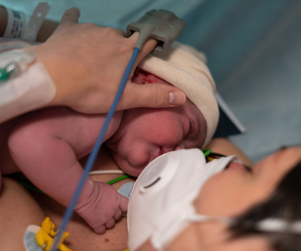 Znieczulenie przy porodzie za darmo. Czy jest naprawdę dostępne dla każdej pacjentki?