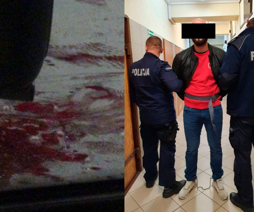 Krwawy atak w Wawrze. 28-latek zaatakował ofiarę siekierą. Nowe ustalenia