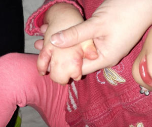Będzin: Straszliwa choroba przysłoniła jej świat. Natalka potrzebuje pomocy