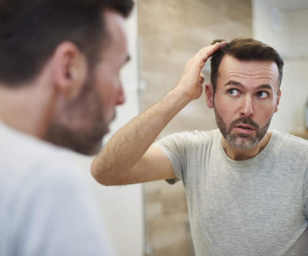 To nie tylko stres. Jeden hormon niszczy męskie włosy, ale możesz go powstrzymać. Sprawdź jak