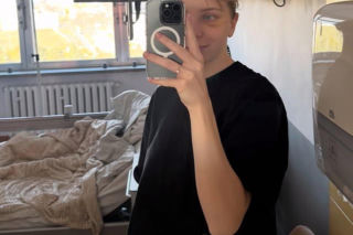 Kamila Sellier po rekonstrukcji oczodołu