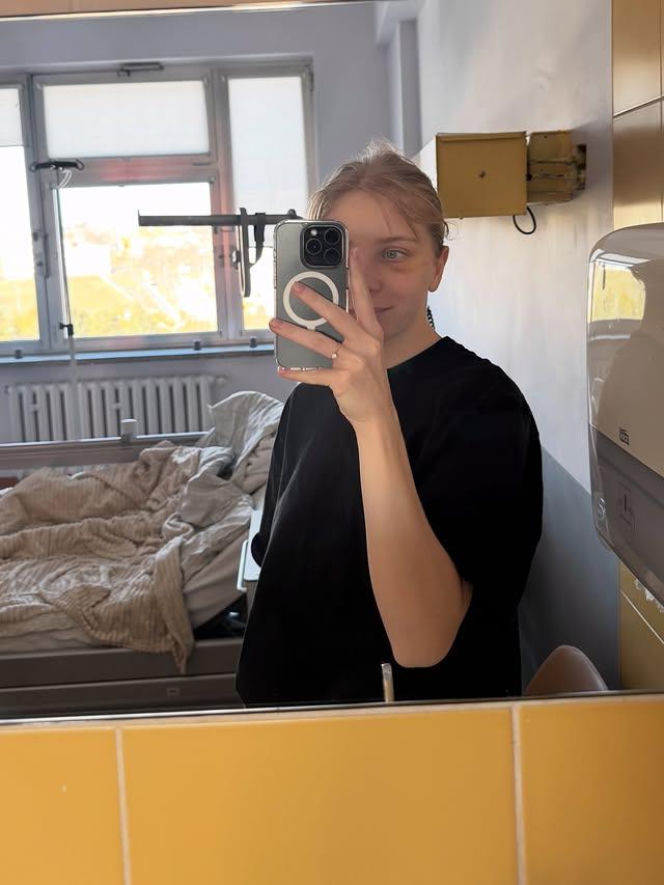 Kamila Sellier po rekonstrukcji oczodołu