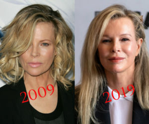 Kim Basinger