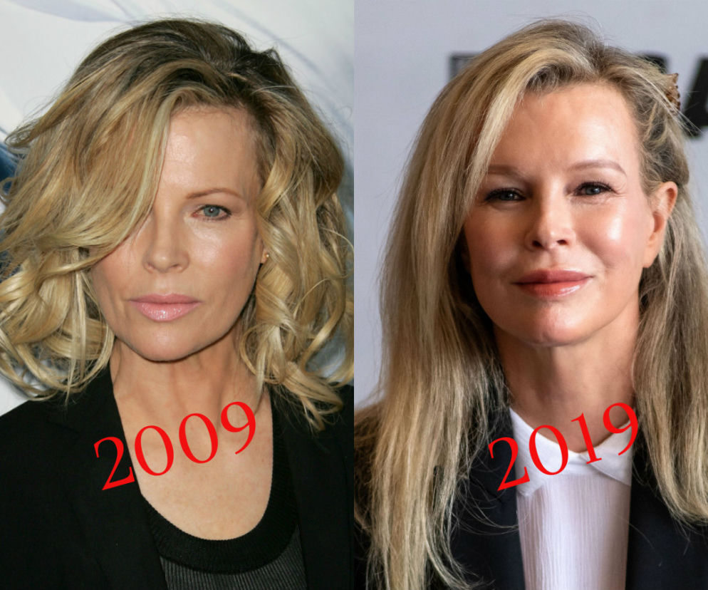 Kim Basinger