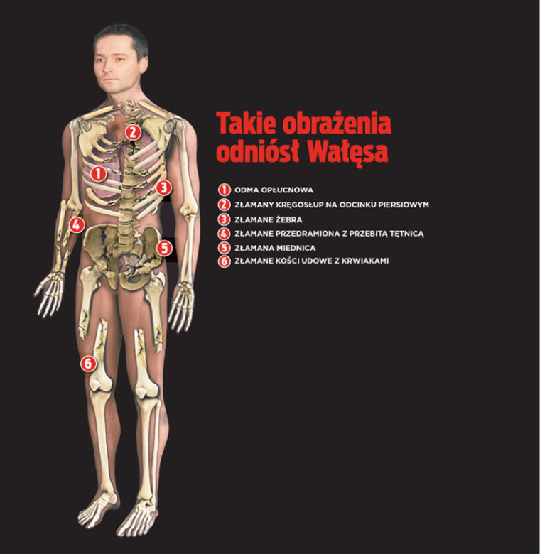 WYPADEK SYNA WAŁĘSY: Był krok od śmierci