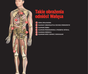 WYPADEK SYNA WAŁĘSY: Był krok od śmierci