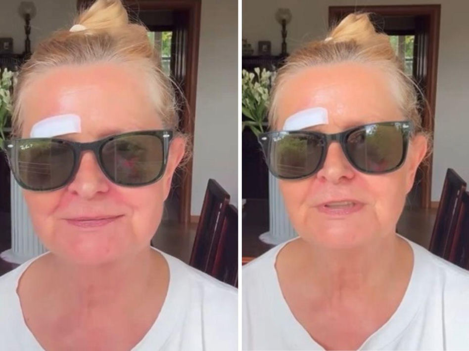 Barbara Busztynowicz miała wypadek! Skończyło się szyciem. "Nikt się nie zatrzymał"